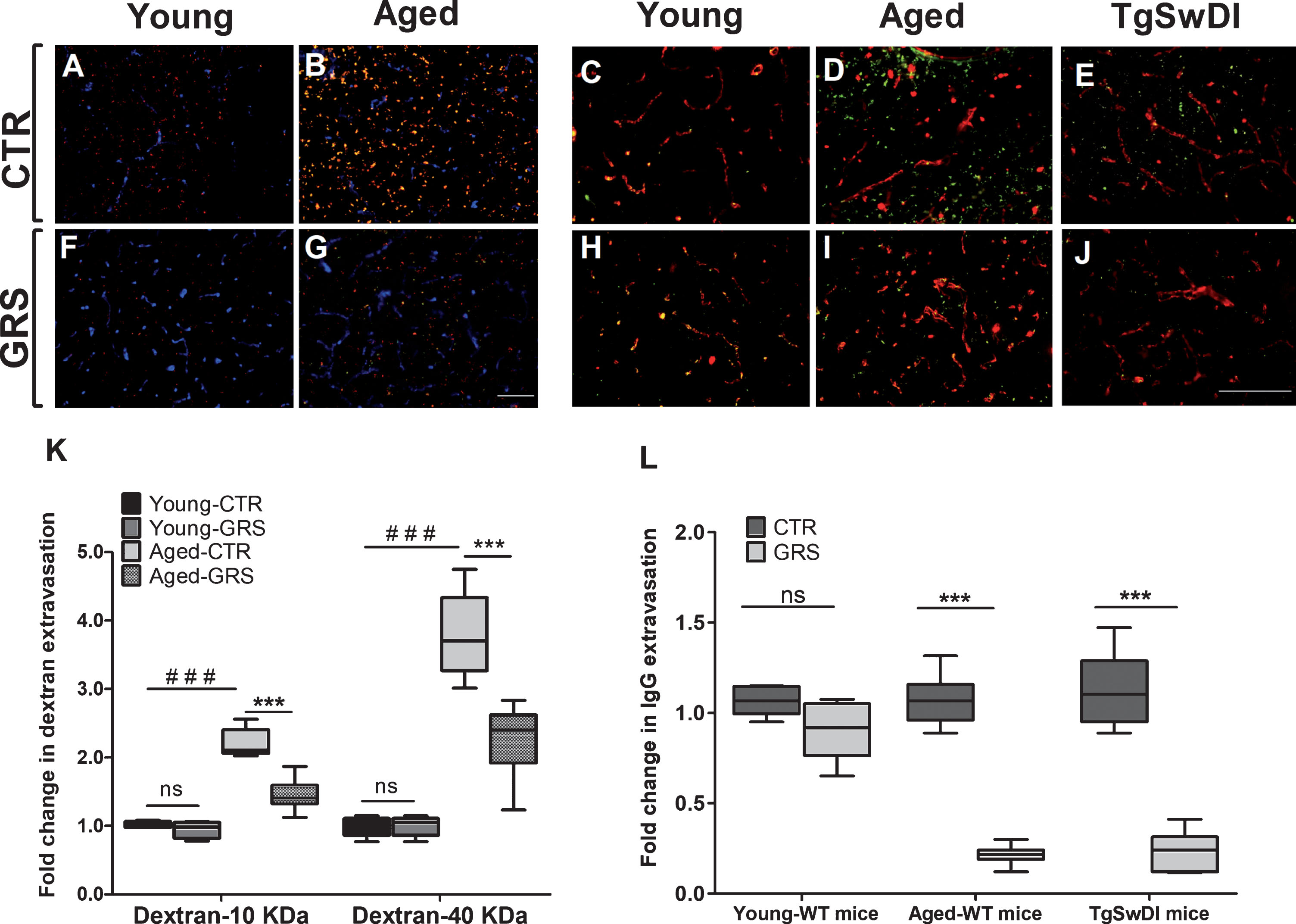 Granisetron Alleviates Alzheimer’s Disease Pathology in TgSwDI Mice ...