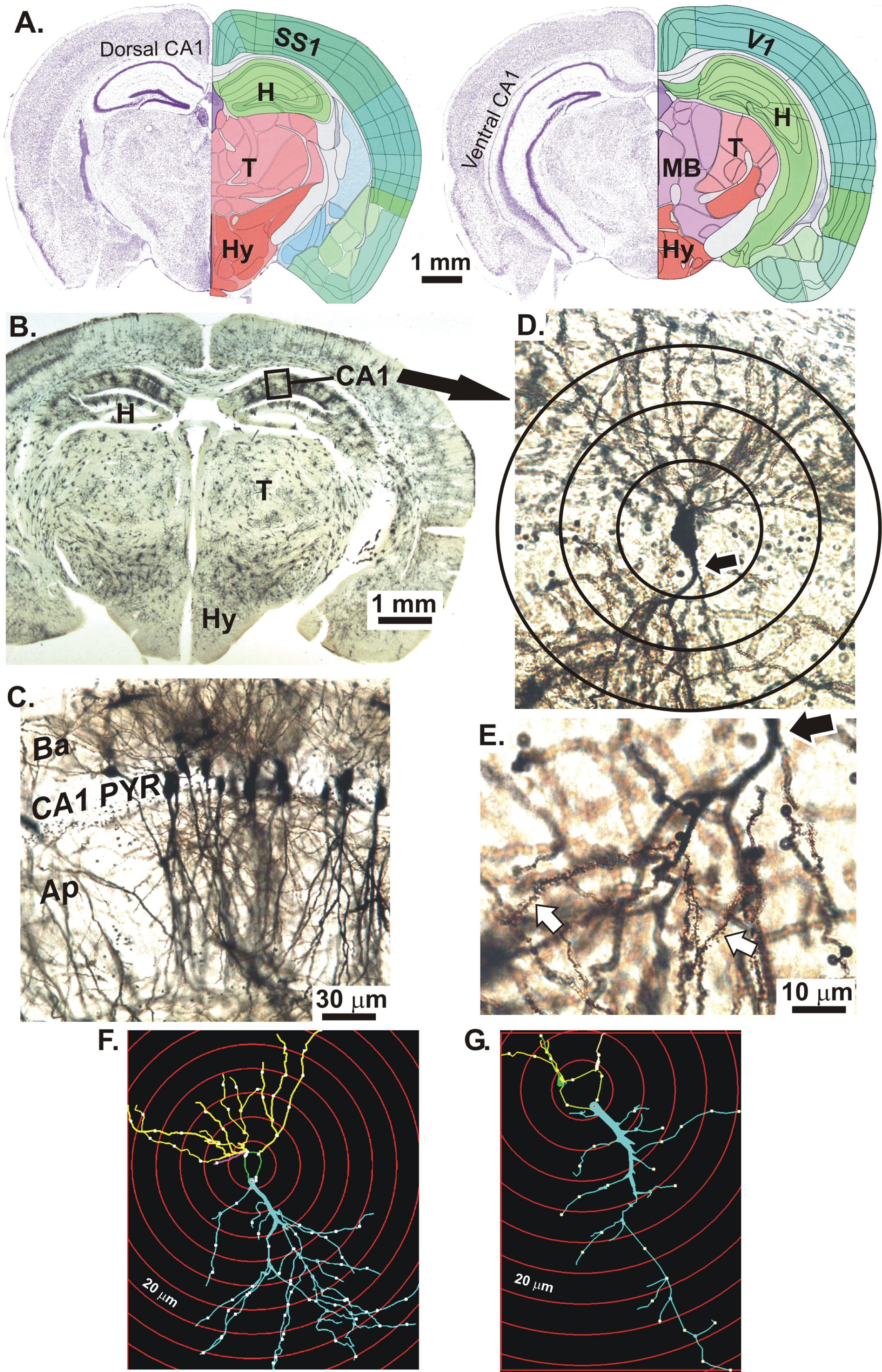 apical dendrite