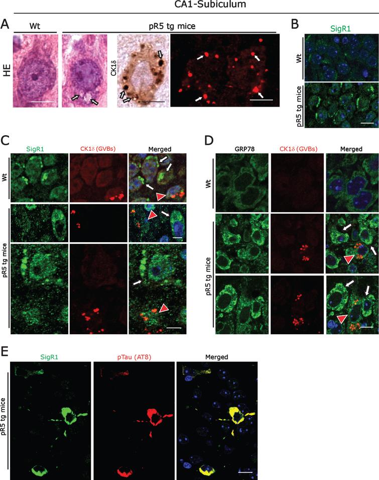 Aggregates Of Rna Binding Proteins And Er Chaperones Linked To Exosomes In Granulovacuolar Degeneration Of The Alzheimer S Disease Brain Ios Press