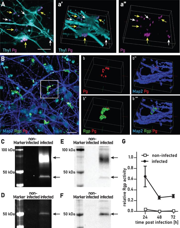 Alzheimer S Disease Like Neurodegeneration In Porphyromonas Gingivalis Infected Neurons With Persistent Expression Of Active Gingipains Ios Press