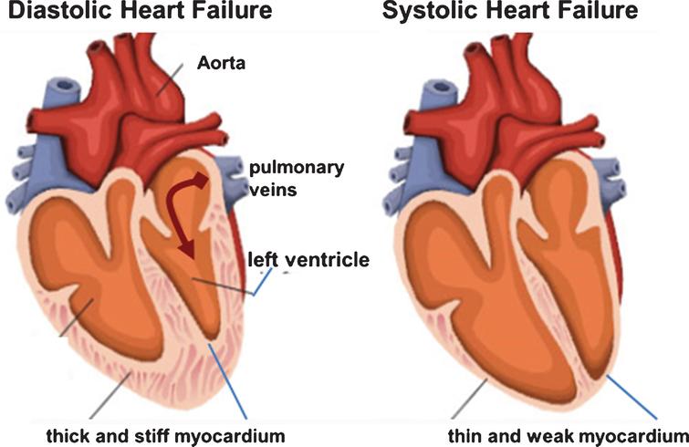 Hemodynamic Instability in Heart Failure Intensifies Age-Dependent ...