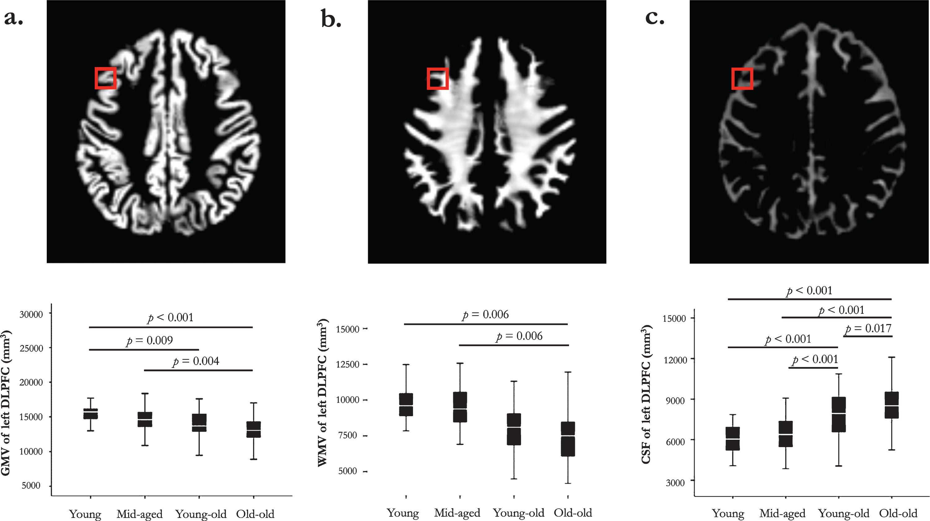 8-185 gray vs. white matter in the CNS Diagram