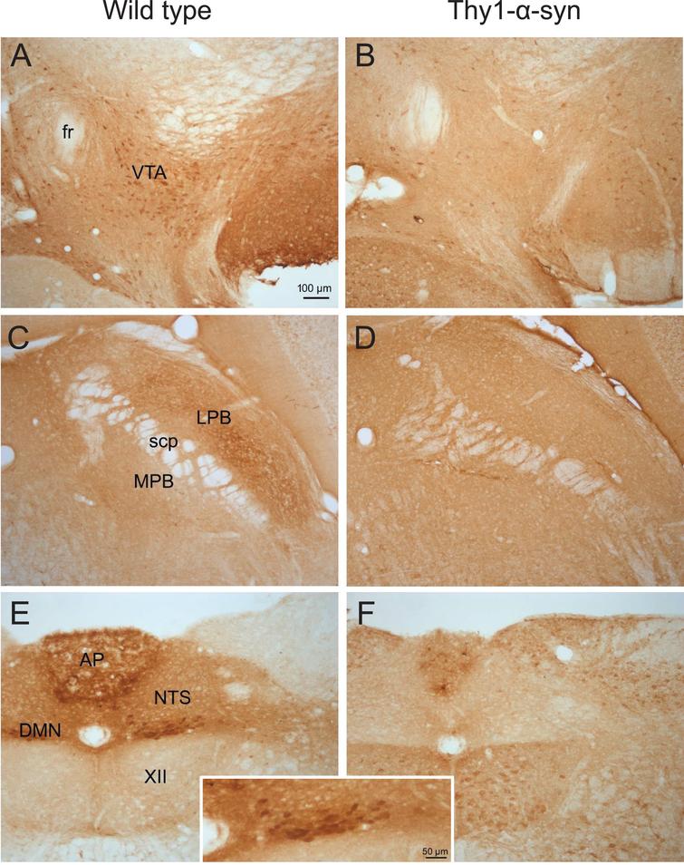 Behavioral Deficits And Brain A Synuclein And Phosphorylated Serine 129 A Synuclein In Male And Female Mice Overexpressing Human A Synuclein Ios Press