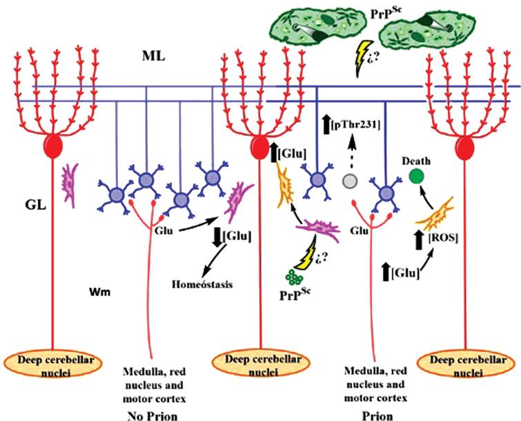 Tau Protein Phosphorylated at Threonine-231 is Expressed Abundantly in ...