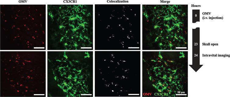 Porphyromonas gingivalis Outer Membrane Vesicles as the Major Driver of ...