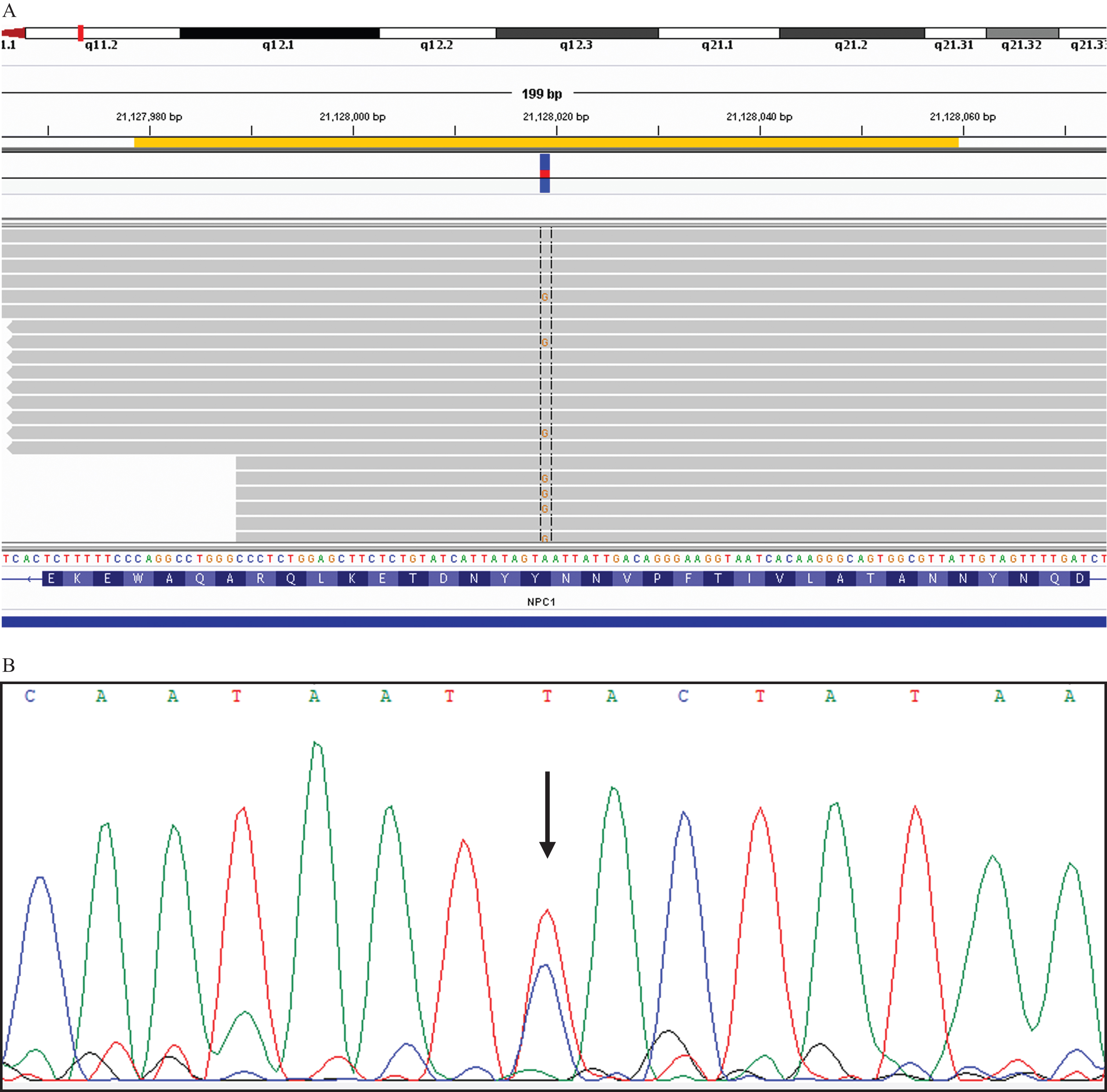 Rapid Diagnosis of 83 Patients with Niemann Pick Type C Disease and Related  Cholesterol Transport Disorders by Cholestantriol Screening - eBioMedicine