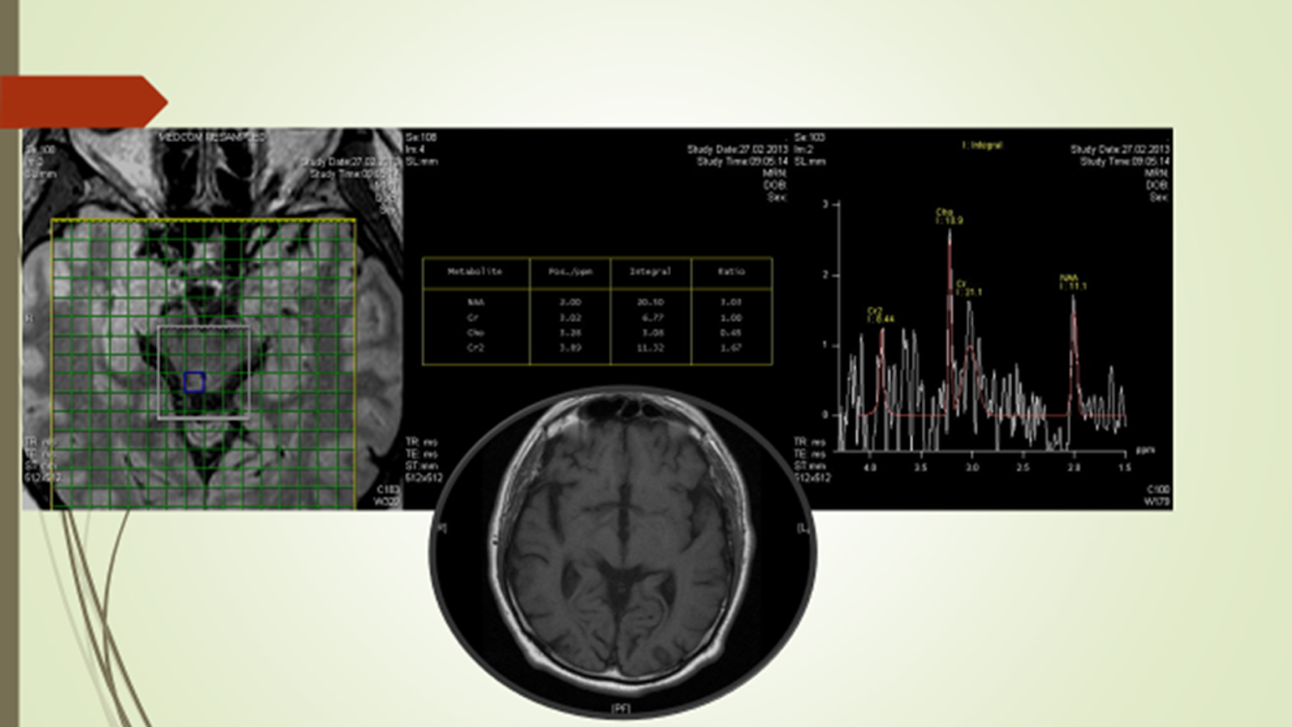 Brain Test Level 411-415 Walkthrough 