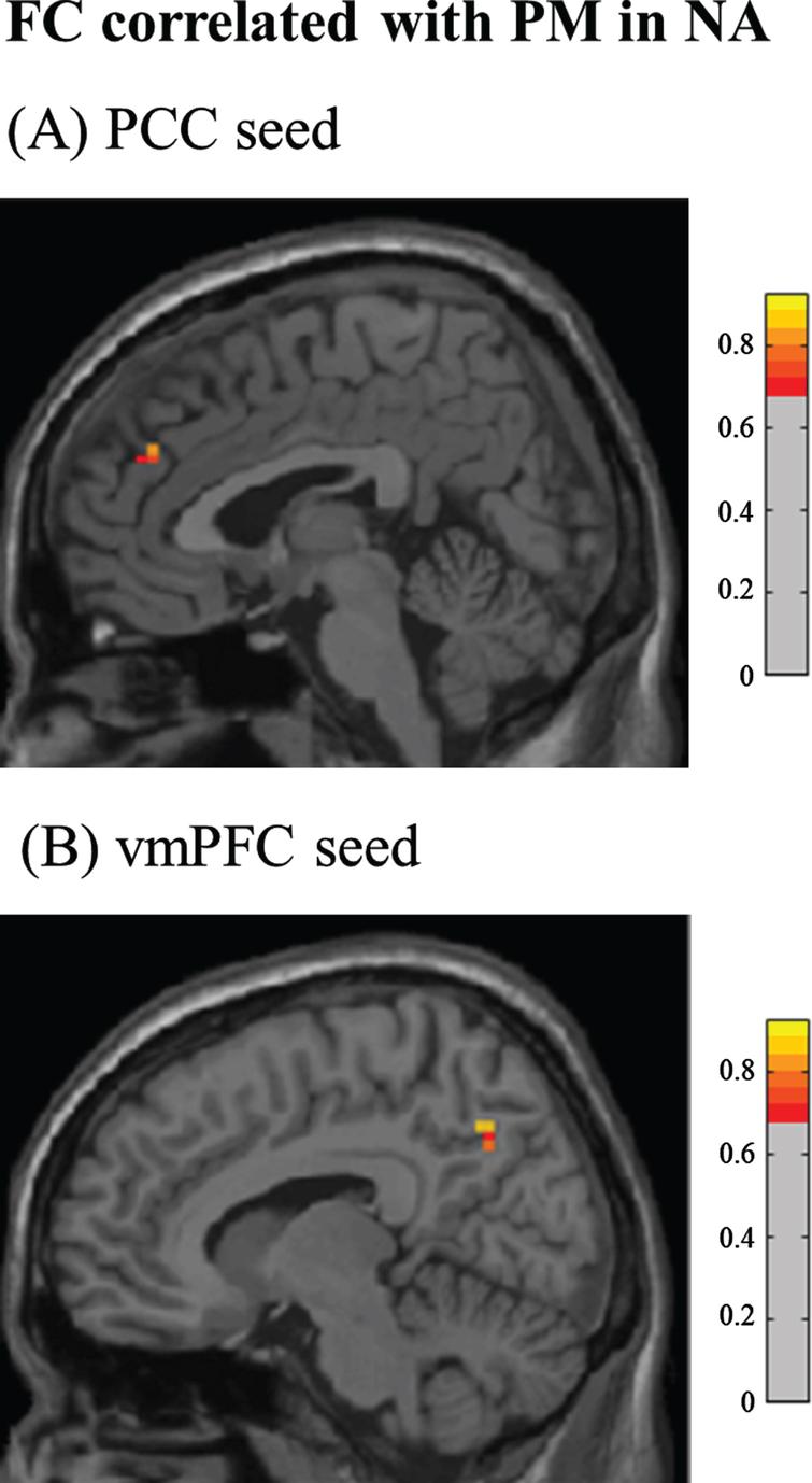 Prospective Memory and Default Mode Network Functional Connectivity in ...