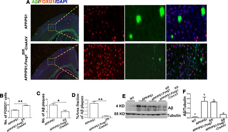 FOXG1 as a Potential Therapeutic Target for Alzheimer’s Disease with a ...