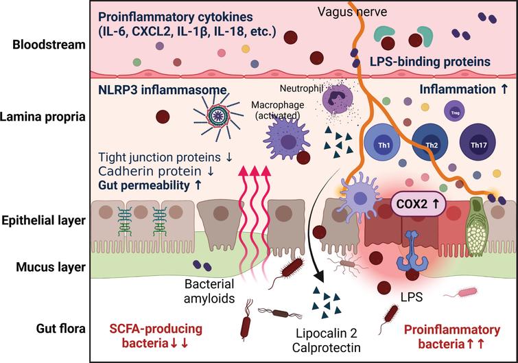 Gut Microbiota as a Hidden Player in the Pathogenesis of Alzheimer’s ...