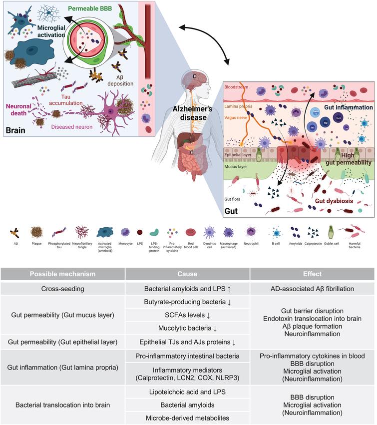 Gut Microbiota as a Hidden Player in the Pathogenesis of Alzheimer’s ...