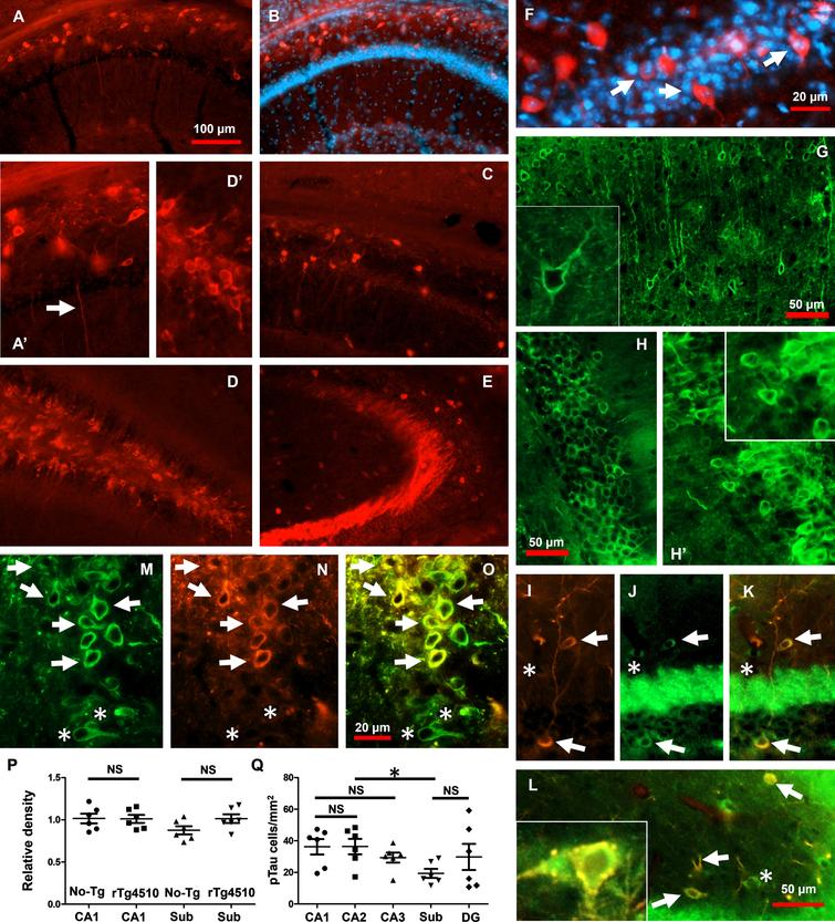 Hyperphosphorylated Tau Relates to Improved Cognitive Performance and ...