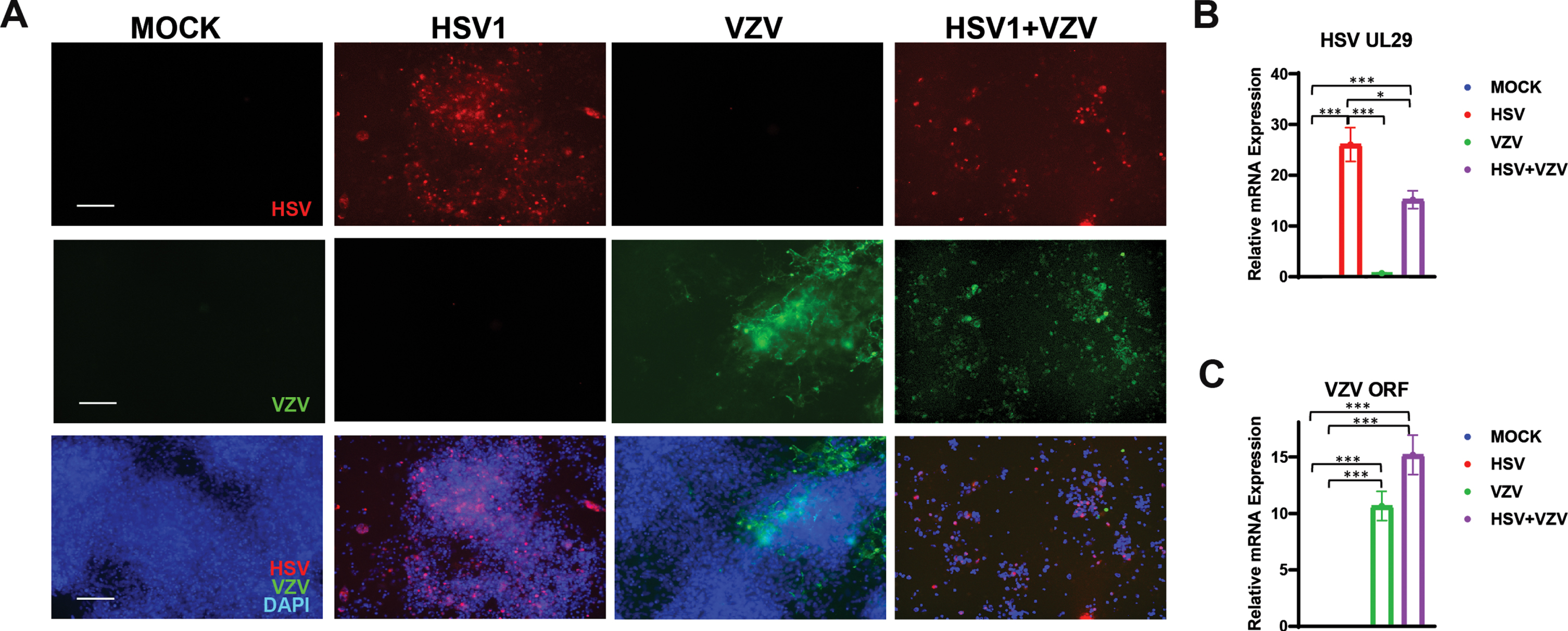 Potential Involvement Of Varicella Zoster Virus In Alzheimer’s Disease ...