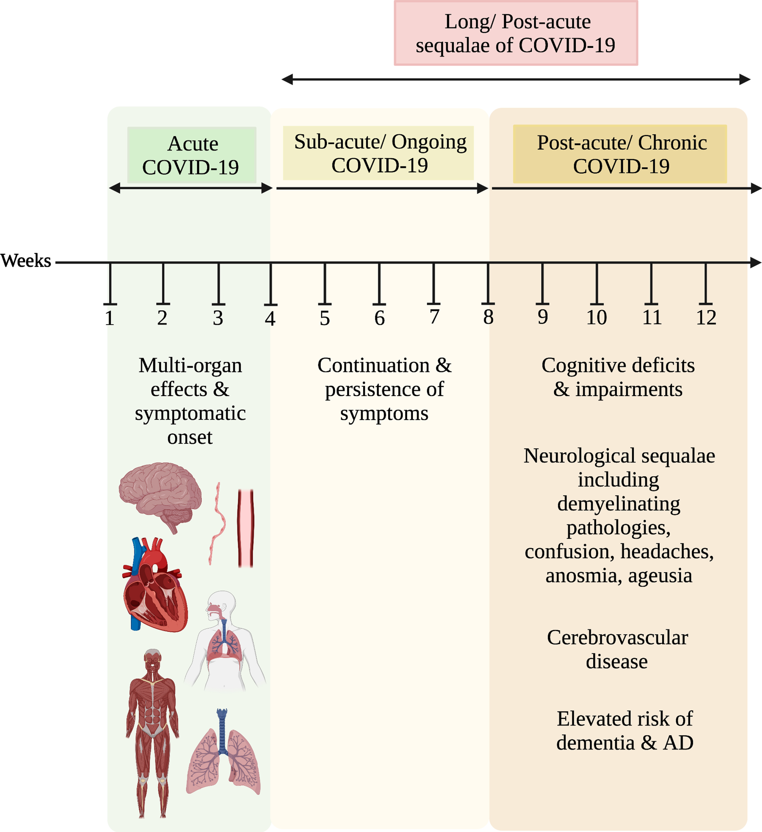 COVID19 as a Risk Factor for Alzheimer’s Disease IOS Press
