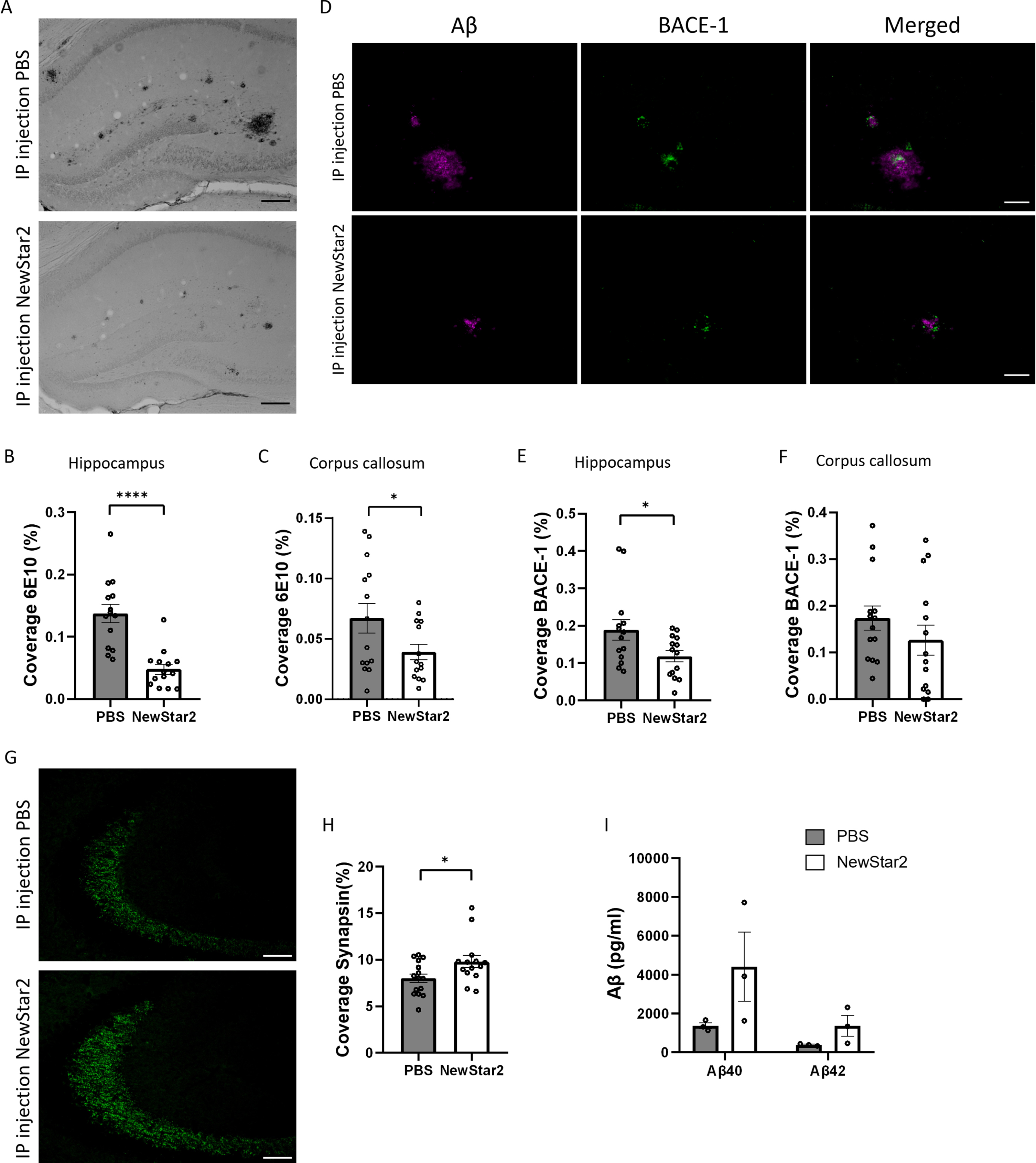 Activation of TNF Receptor 2 Improves Synaptic Plasticity and Enhances ...