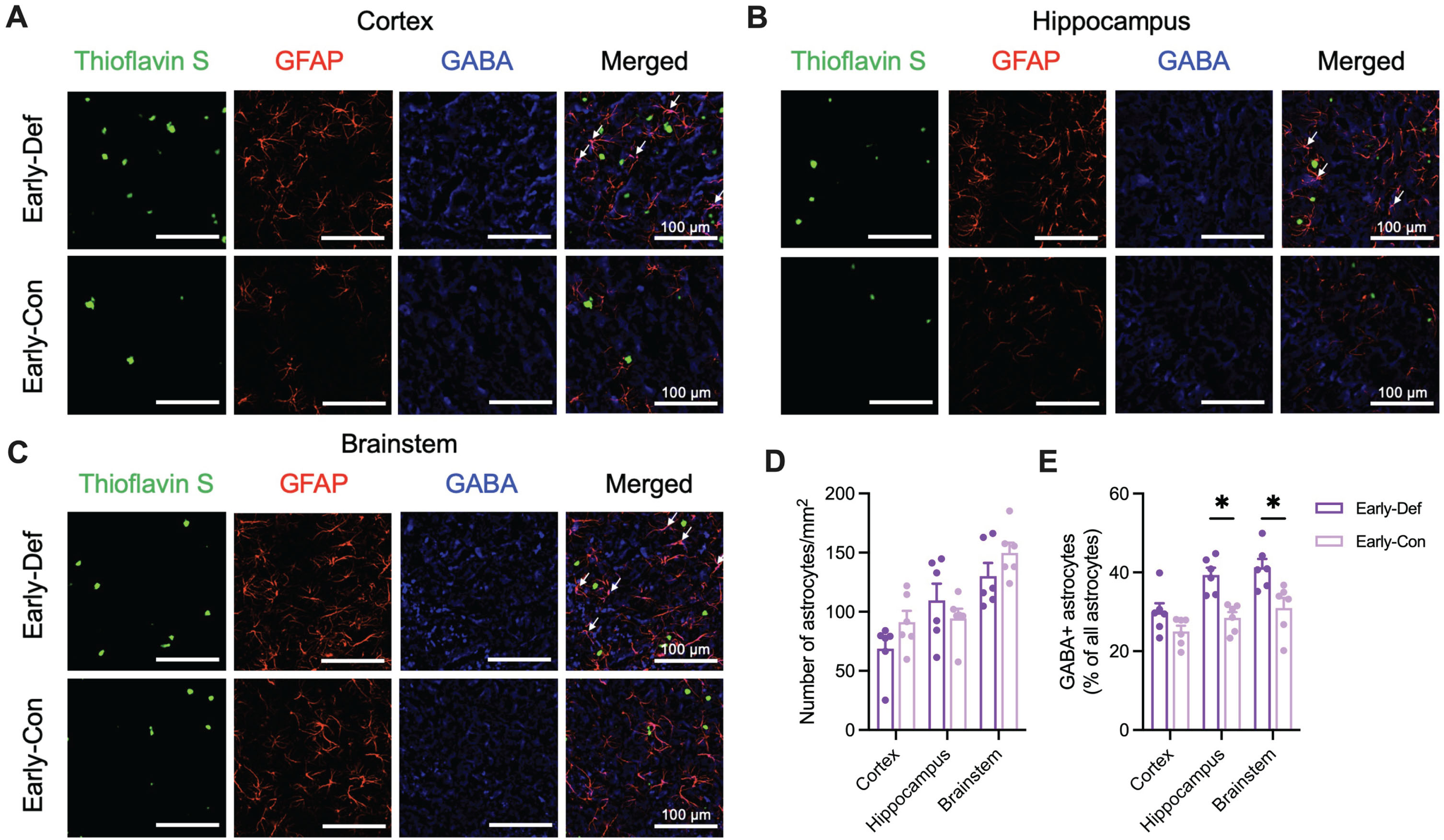 Vitamin D Reduces GABAPositive Astrocytes in the 5xFAD Mouse Model of