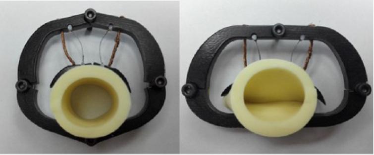 A Novel Artificial Anal Sphincter With Constant Force Ios Press 1060