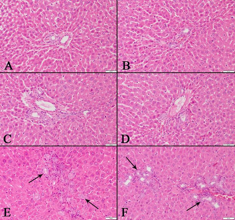 Effects of mulberry extract on the liver pathology and serum ...