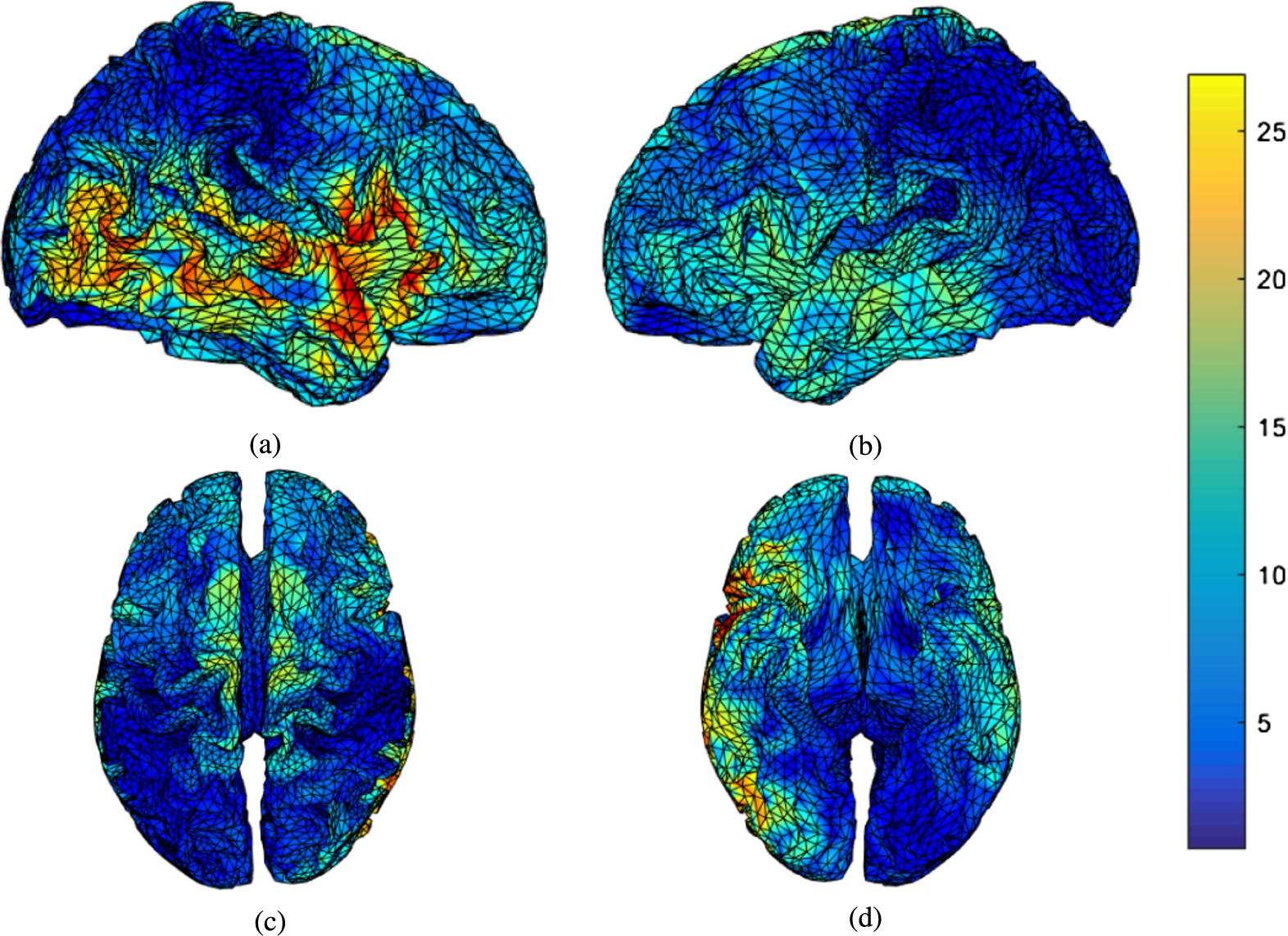 How mental fatigue affects the neural sources of P300 component? - IOS Press