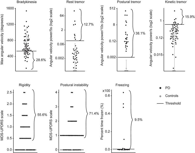 Cardinal Motor Features of Parkinson’s Disease Coexist with Peak-Dose ...