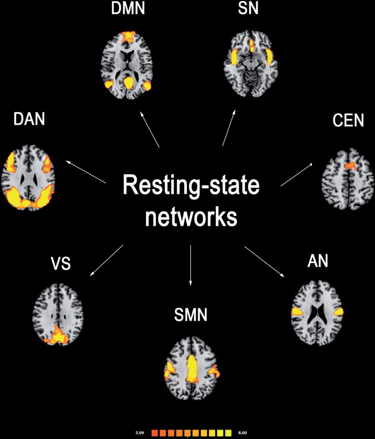 Functional Connectivity Signatures Of Parkinson S Disease Ios Press