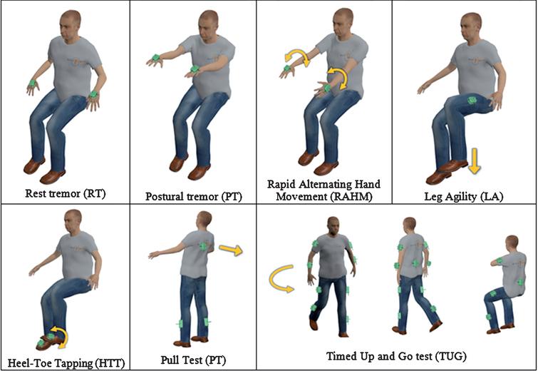 Technology-Based Objective Measures Detect Subclinical Axial Signs in ...