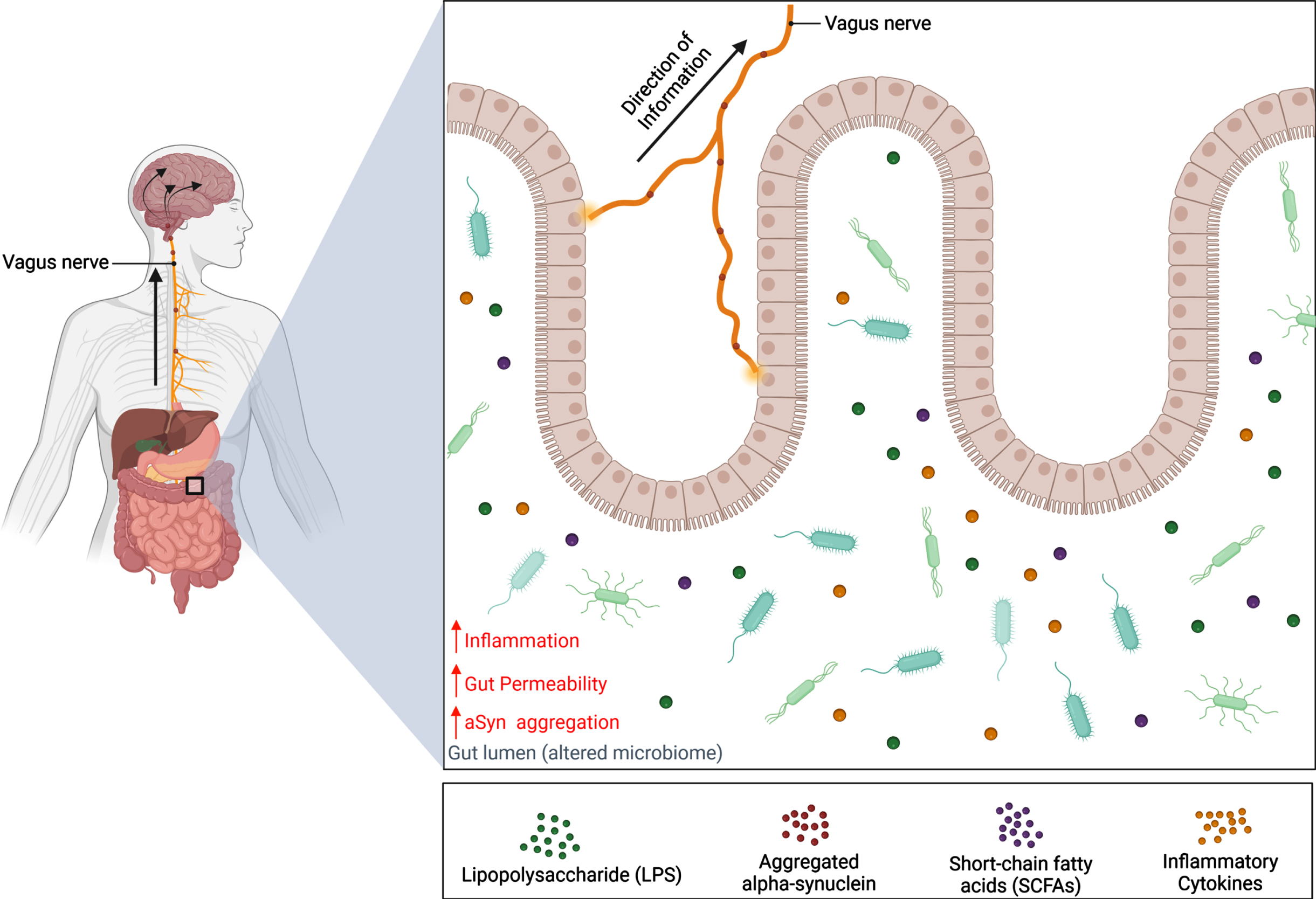 Exploring The Connection Between The Gut Microbiome And Parkinson’s ...