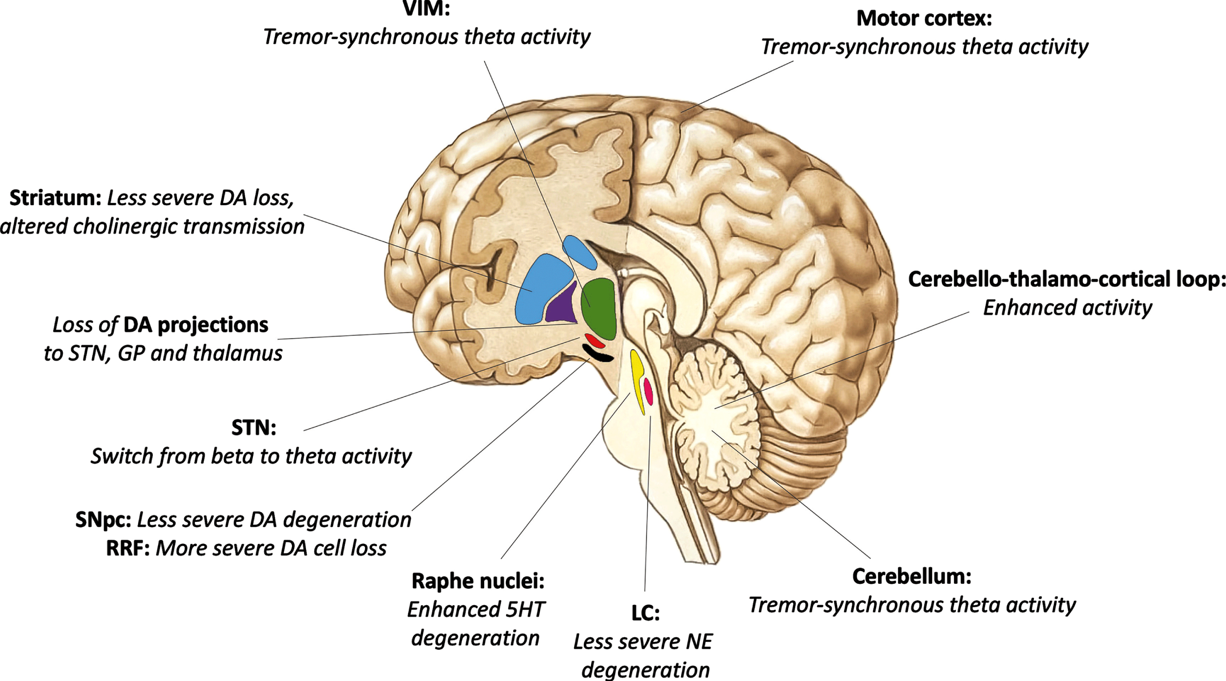 Pharmacological Treatment Of Tremor In Parkinsons Disease Revisited