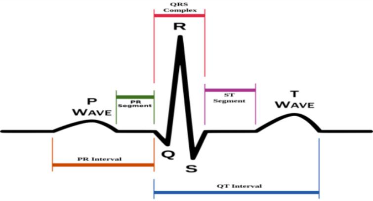 Identification of myocardial infarction from analysis of ECG signal ...