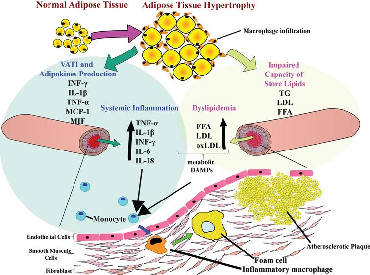 Synergistic Role Among Adipose Tissue Hypertrophy, Dyslipidemia, and ...