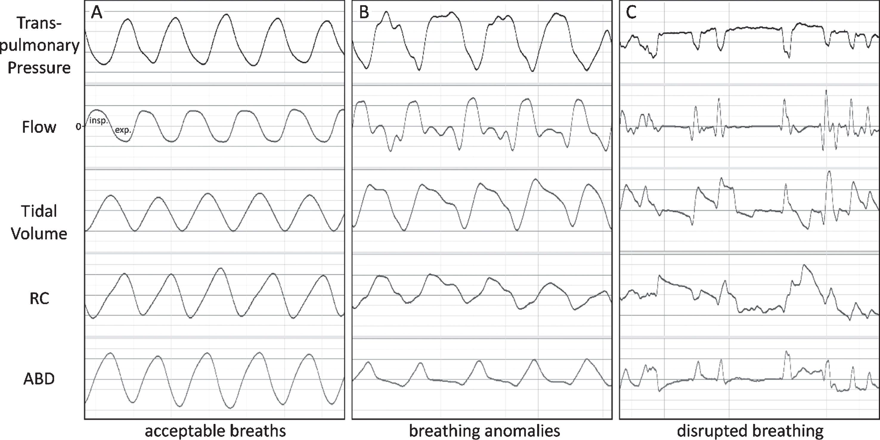 adventitious breath sounds in infant