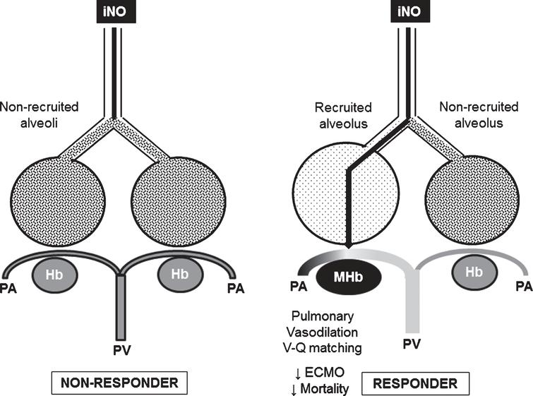 Methemoglobin and the response to inhaled nitric oxide in persistent ...