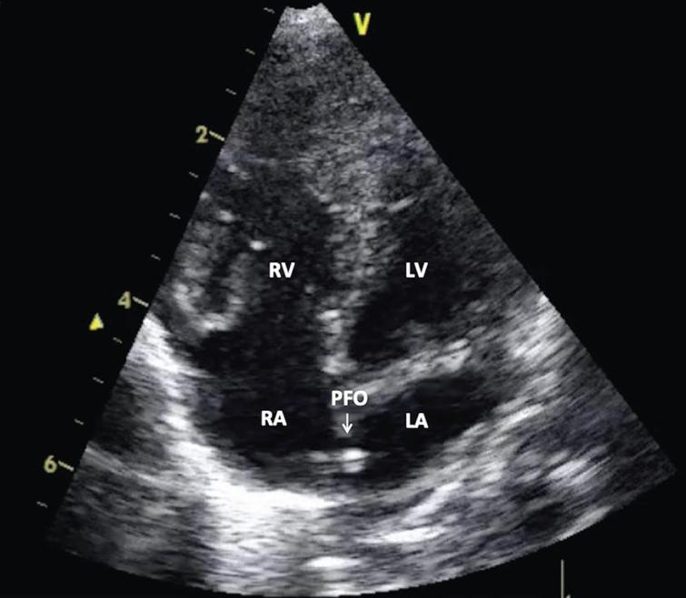 Bedside sonography performed by neonatology residents to confirm ...