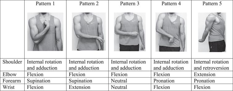 Association between postural patterns of spastic upper extremity and ...