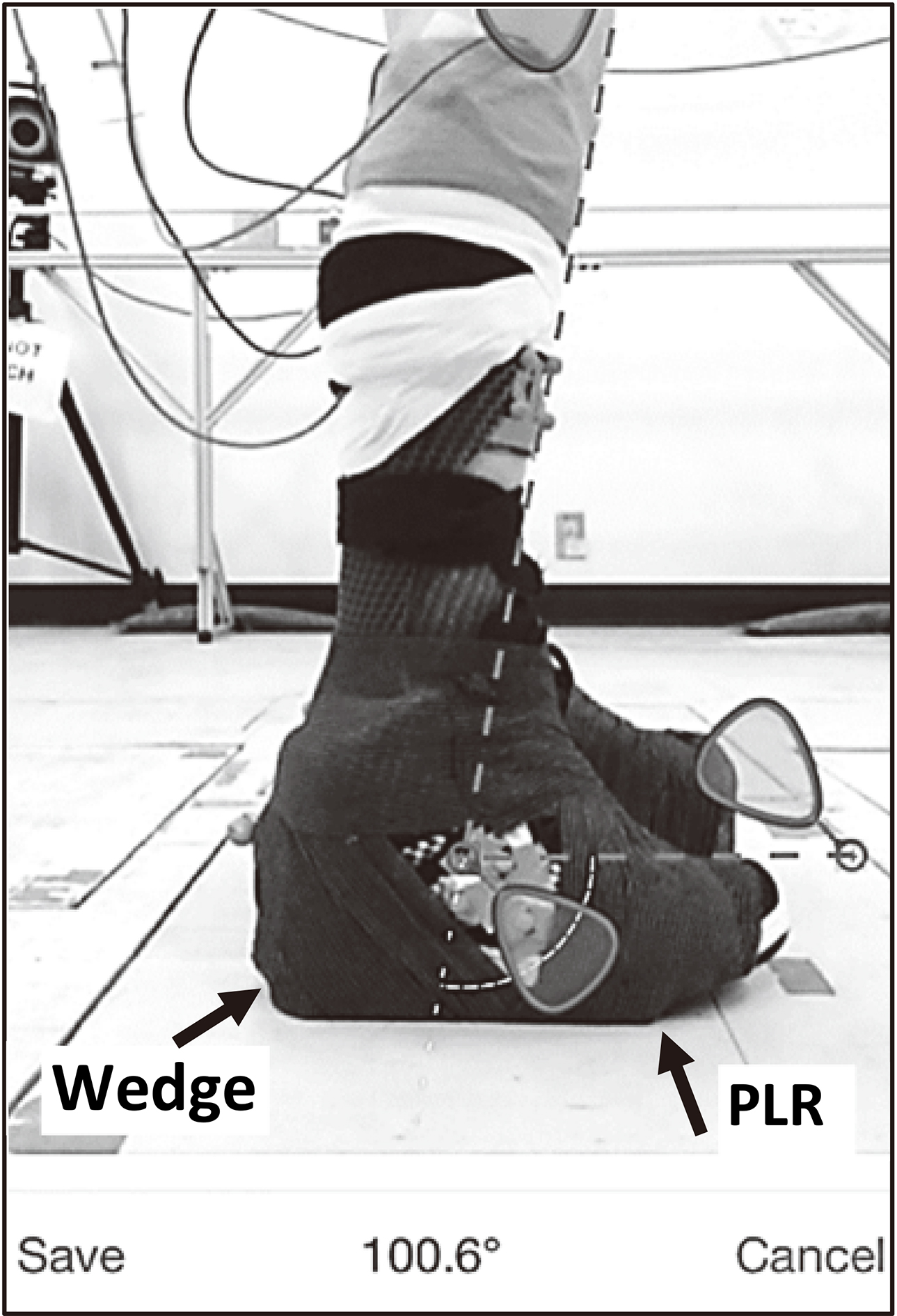 Effects of solid anklefoot orthoses with individualized ankle angles