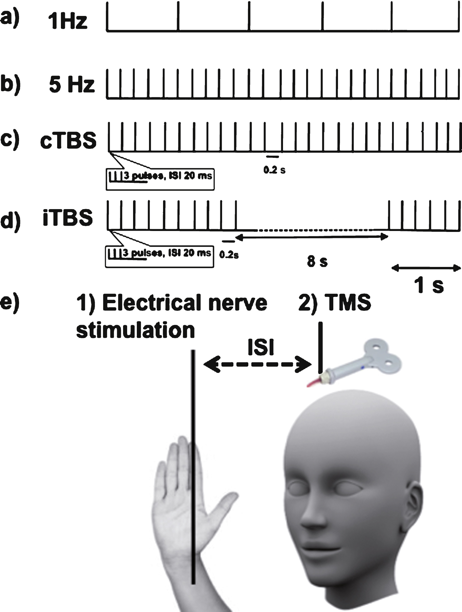 Repetitive Transcranial Magnetic Stimulation For Stroke Rehabilitation ...