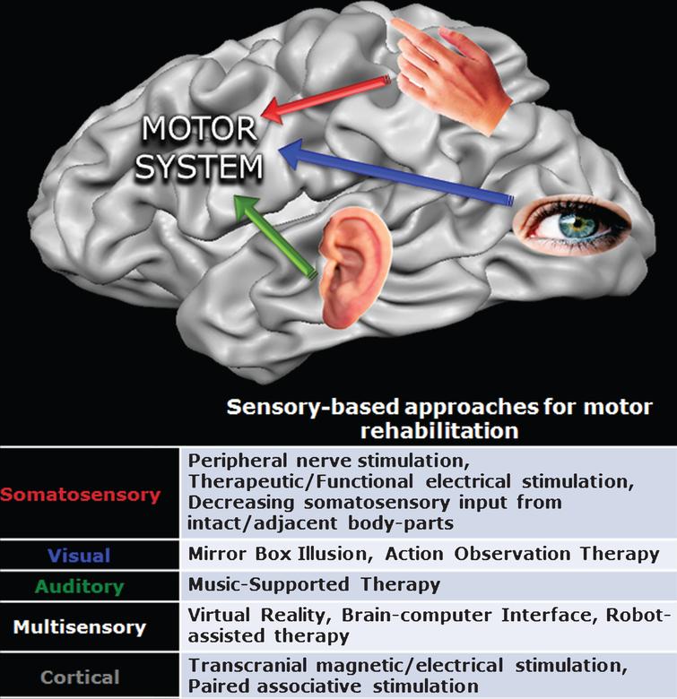 The sensory side of poststroke motor rehabilitation IOS Press