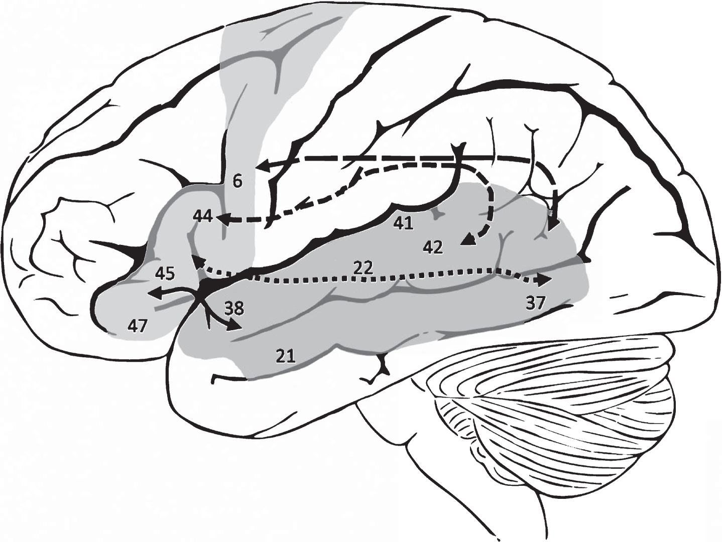 The pathophysiology of post-stroke aphasia: A network approach - IOS Press