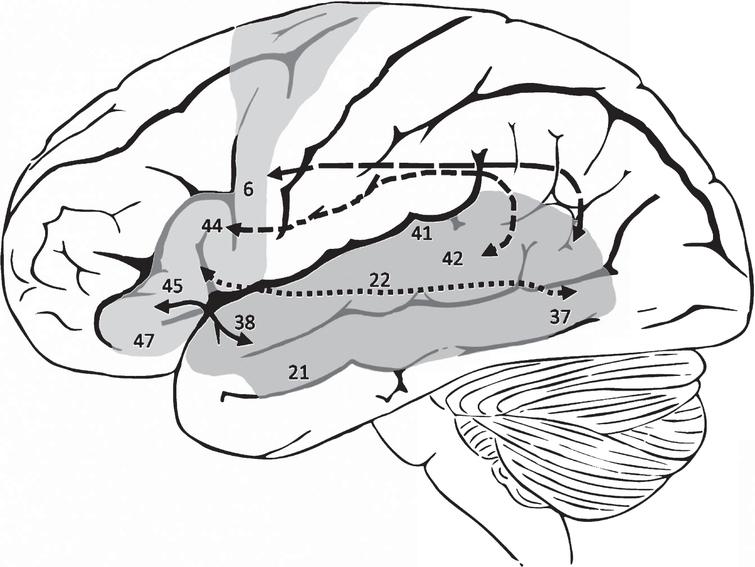 The pathophysiology of post-stroke aphasia: A network approach - IOS Press