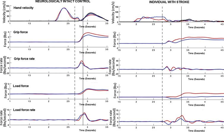 Bimanual coordination: A missing piece of arm rehabilitation after ...