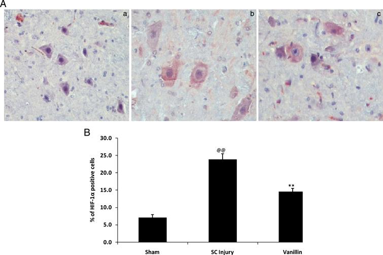 Vanillin Ameliorates Changes In Hif 1 A Expression And Neuronal Apoptosis In A Rat Model Of Spinal Cord Injury Ios Press