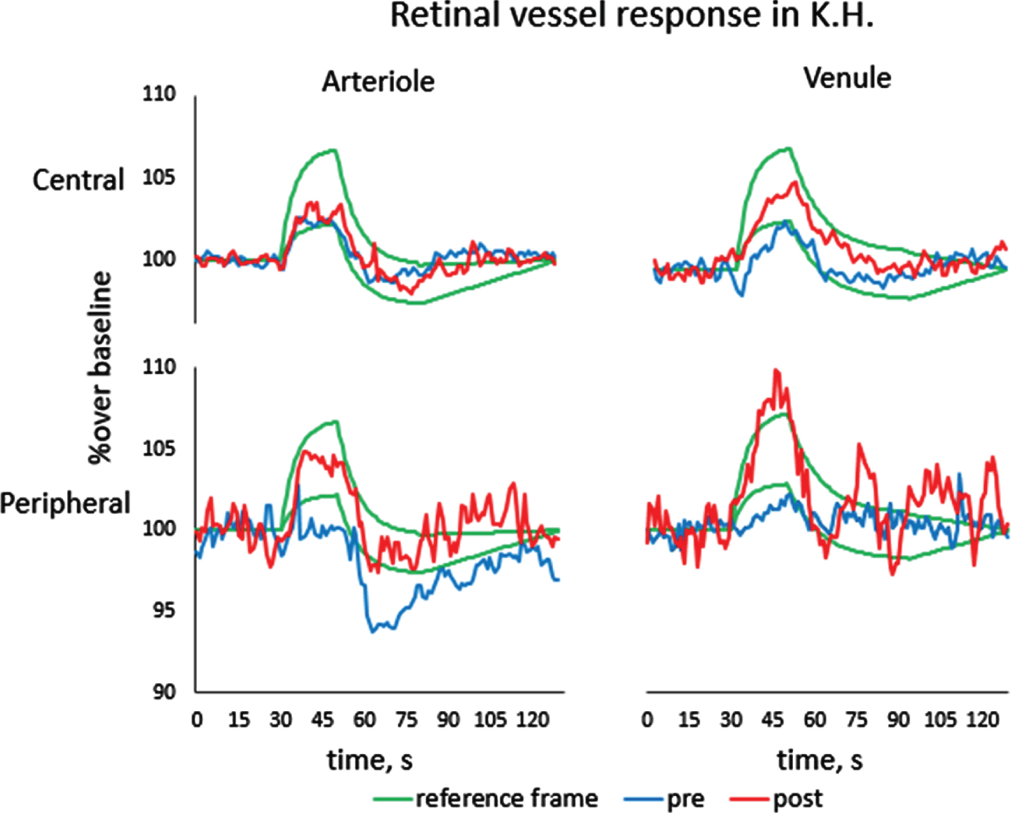 Frontiers  Retinal Vessel Responses to Flicker Stimulation Are