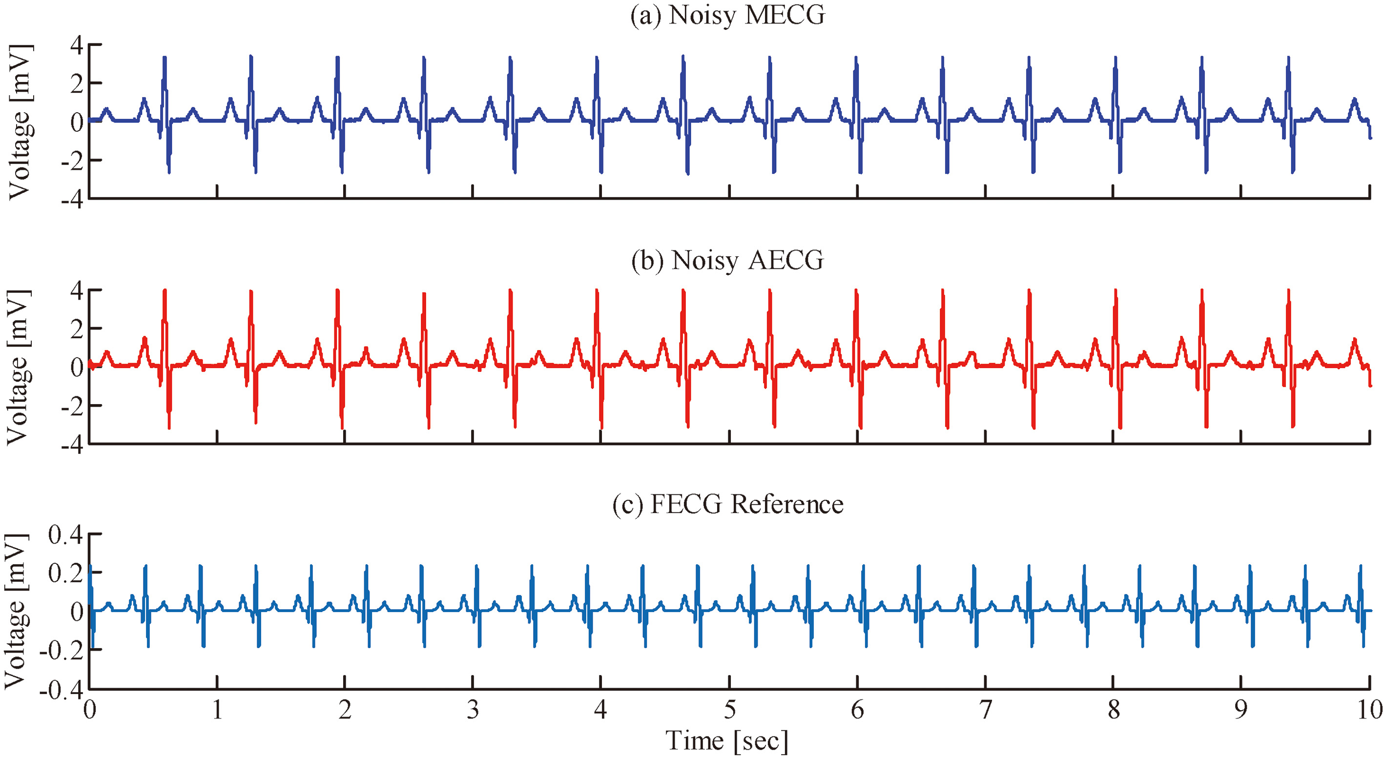 Non-invasive Fetal ECG Extraction Using Discrete Wavelet Transform ...