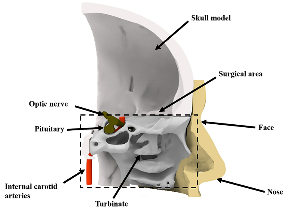 The Manufacturing Procedure Of 3D Printed Models For Endoscopic ...