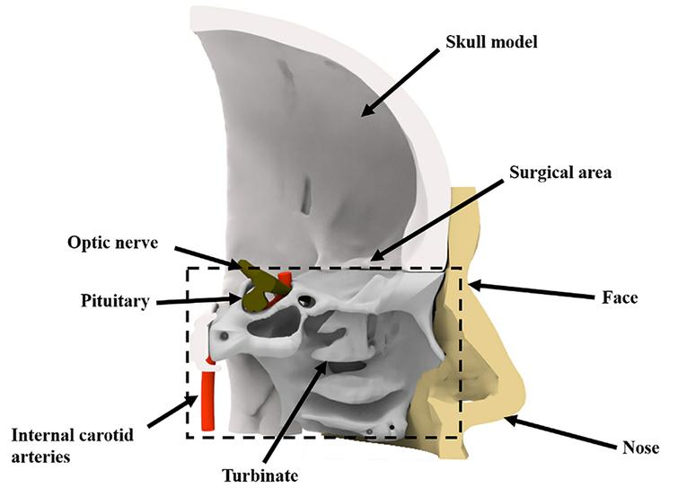 The Manufacturing Procedure Of 3d Printed Models For Endoscopic Endonasal Transsphenoidal Pituitary Surgery Ios Press