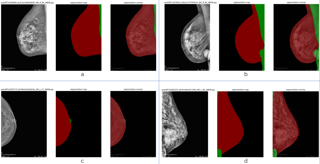 Deep Learning Based Breast Region Extraction Of Mammographic Images Combining Pre Processing 7428