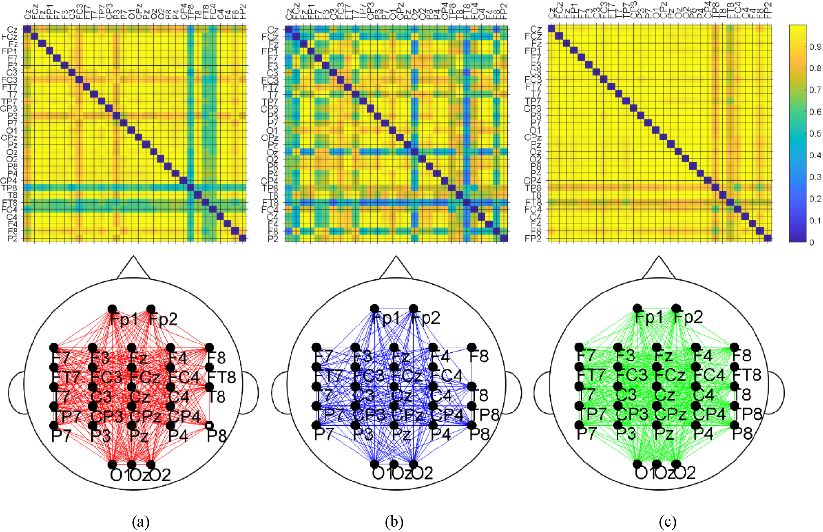 Altered Brain Functional Networks After Quchi (LI 11) Acupuncture: An ...