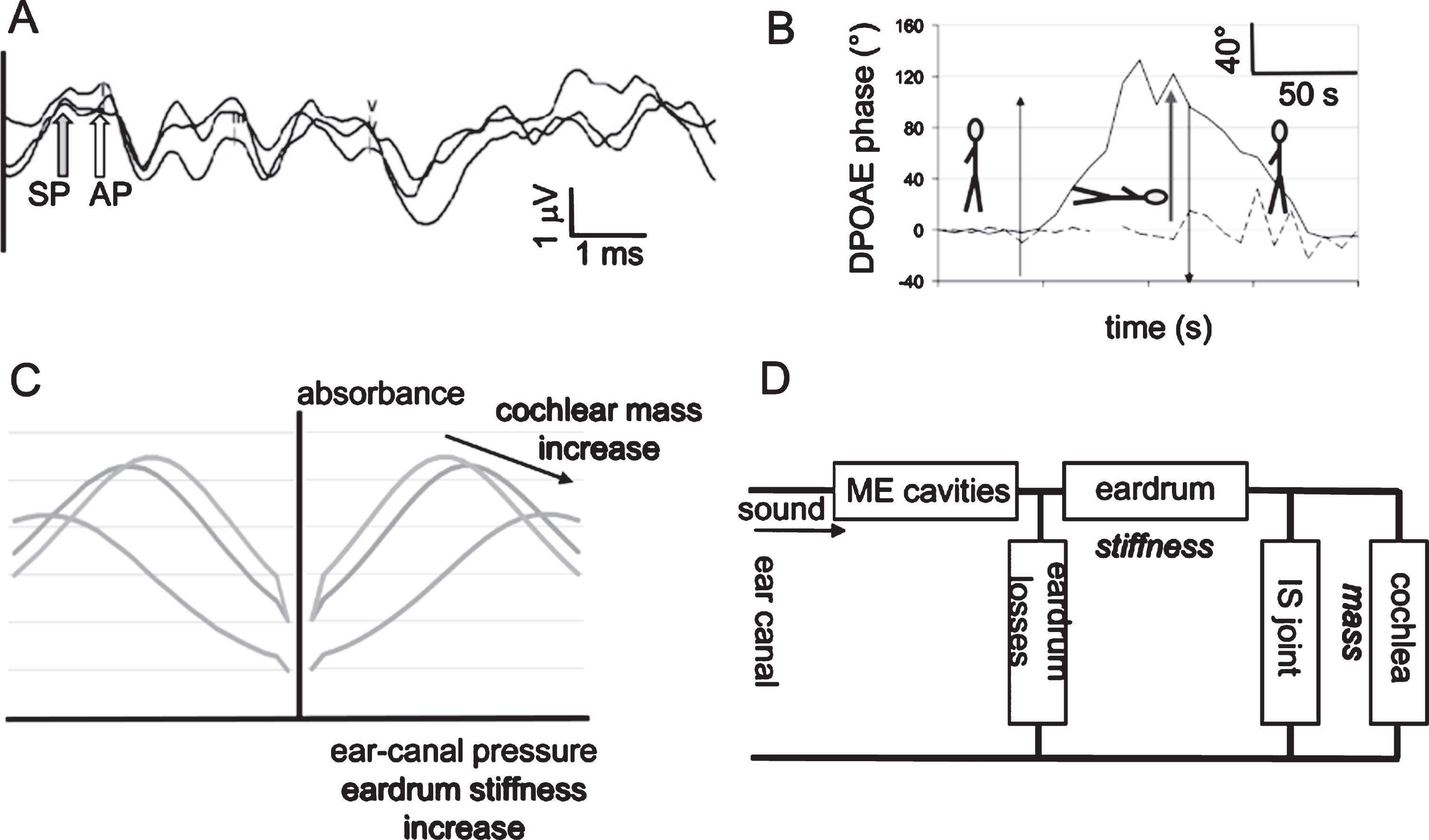 Auditory biophysics of endolymphatic hydrops - IOS Press