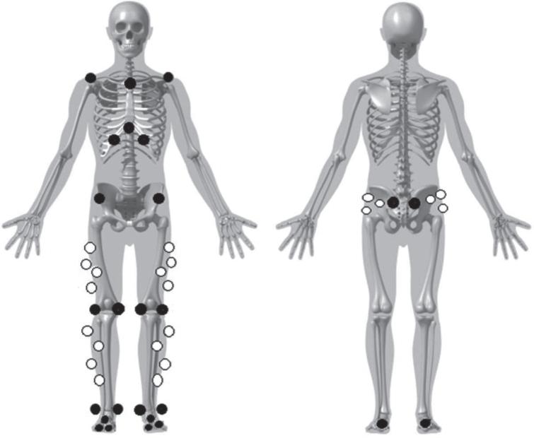 Gait asymmetry and rating of perceived exertion: How are they ...