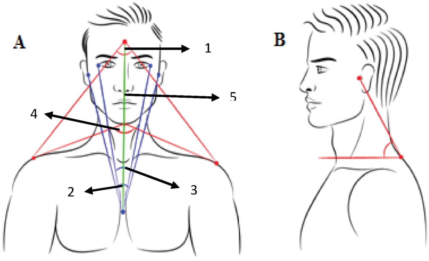 Correlation between craniovertebral angle in the sagittal plane and ...